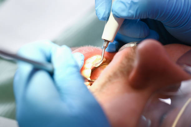 Best Cracked Tooth Emergency Dentist  in Grand Saline, TX