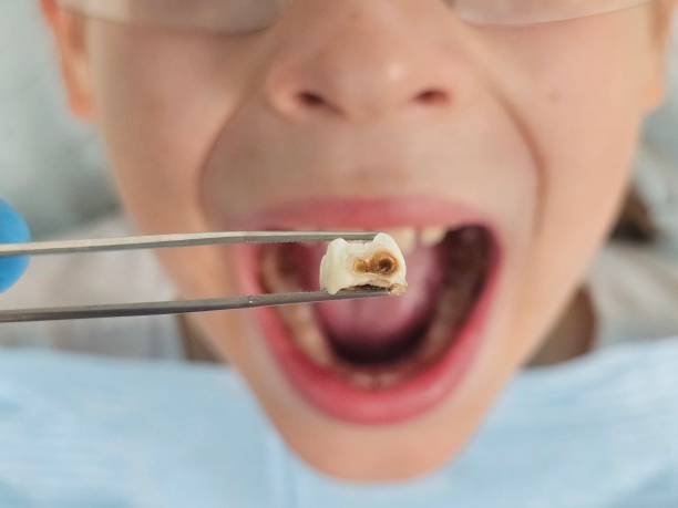 Best Emergency Gum Pain Relief  in Grand Saline, TX